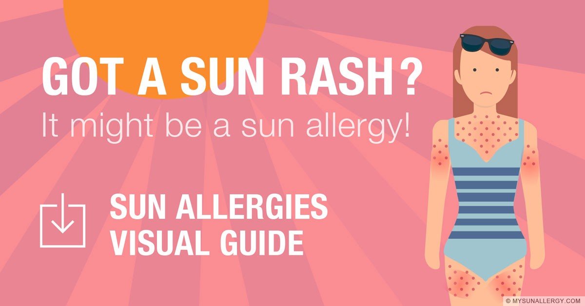 Sun Rash Visual Guide My Sun Allergy